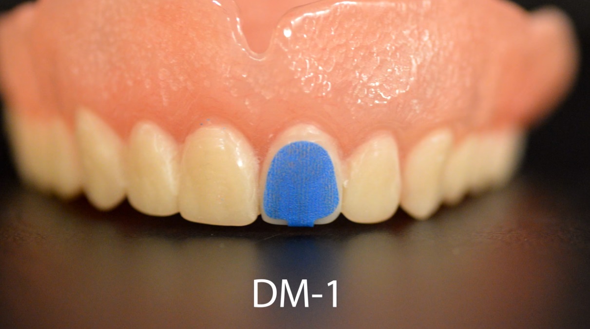 Scaneez DentureMark Value Pack Magic Xray Markers